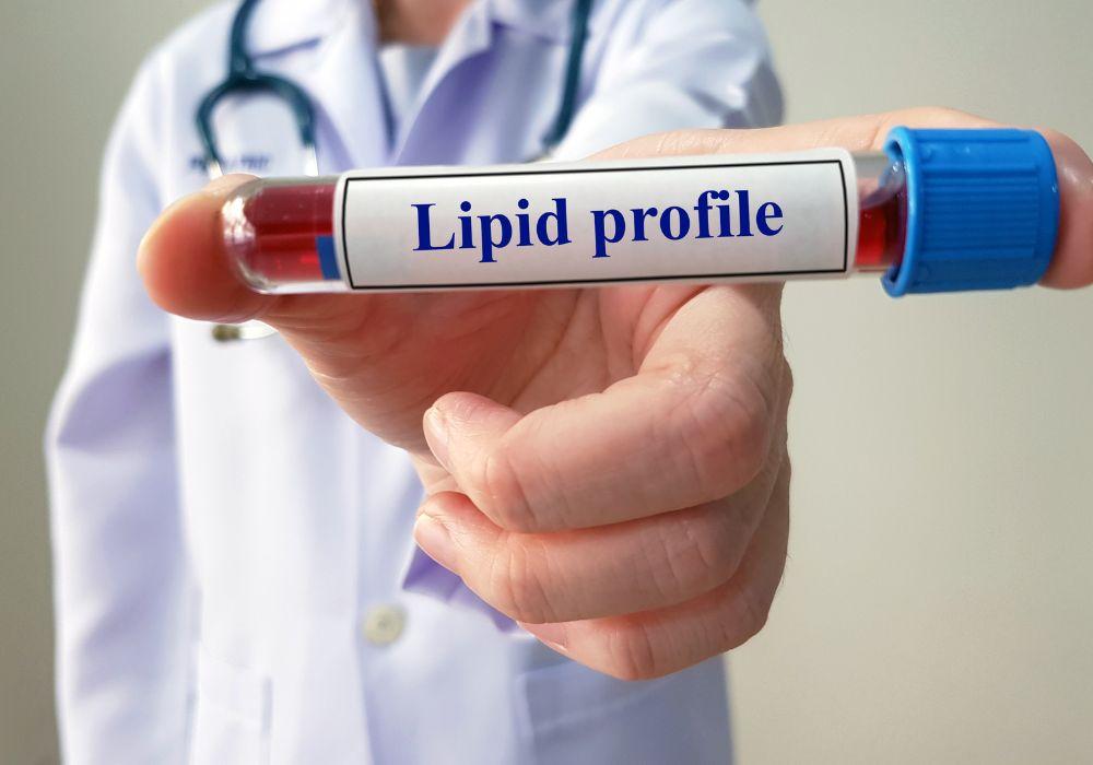 Lipid Profile Blood Test: A Window into Cardiovascular Health