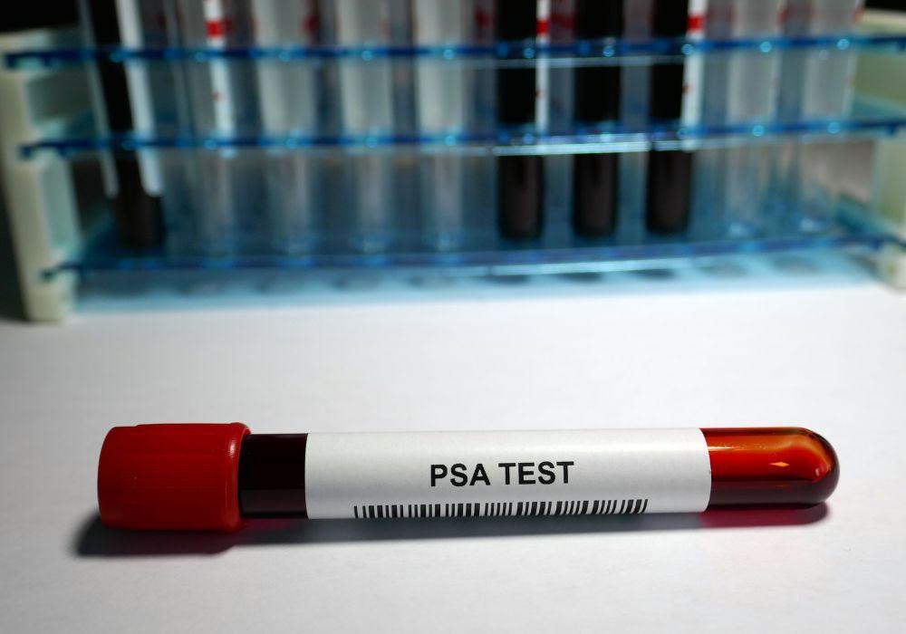 Prostate-Specific Antigen (PSA) Testing: A Key to Prostate Health