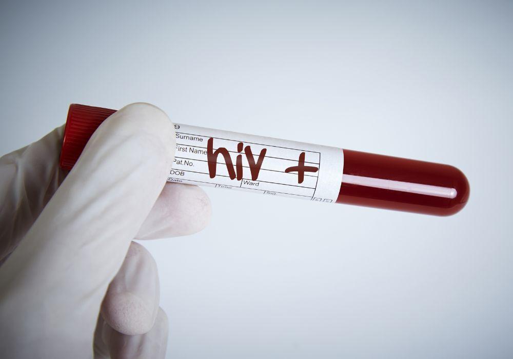 HIV Uncovered: Symptoms, Differences, and the Pursuit of a Cure